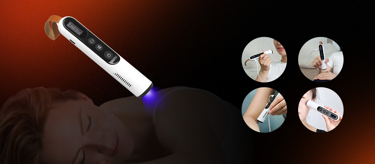 Handheld UVB therapy on leg