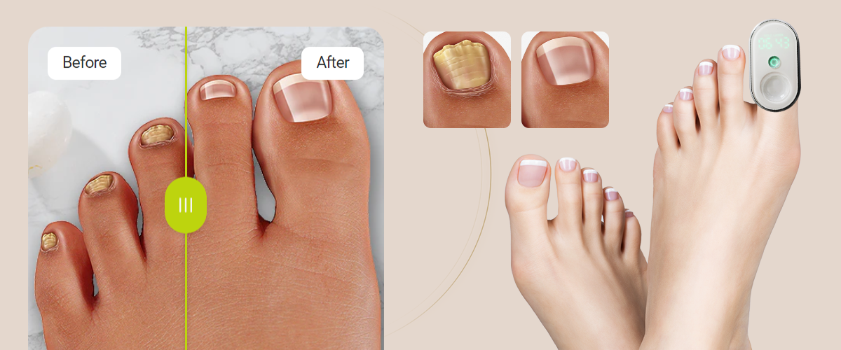 Visible Before & After