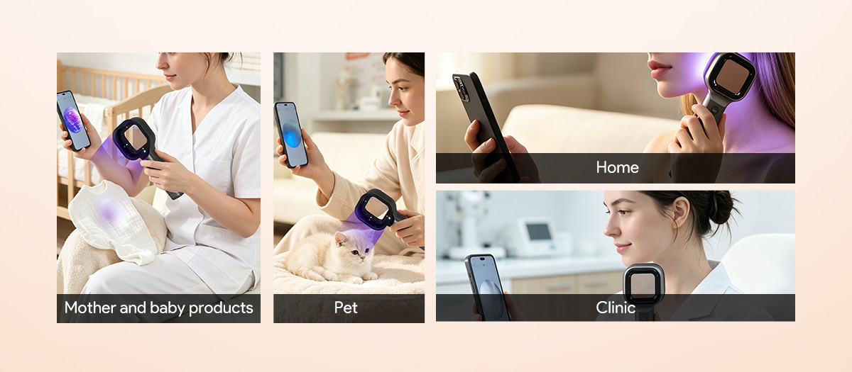 Handheld UVB therapy on leg